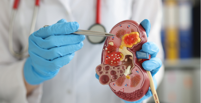 Robotasszisztált urológiai műtétek