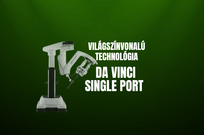 Világszínvonalú technológia – Single Port